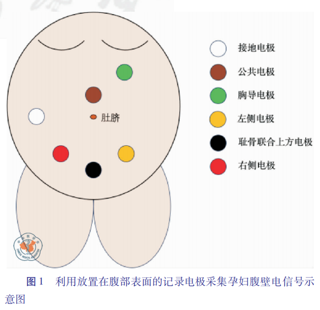 toco 怎么看宫缩综述丨宫缩监测的研究进展及临床应用_https://www.jmylbn.com_新闻资讯_第8张