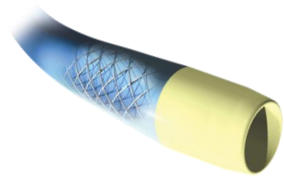 动脉长鞘怎么置入桡胜一筹丨杨敏教授团队：应用Brite Tip Radianz长鞘经远桡动脉治疗肾动脉狭窄一例_https://www.jmylbn.com_新闻资讯_第33张