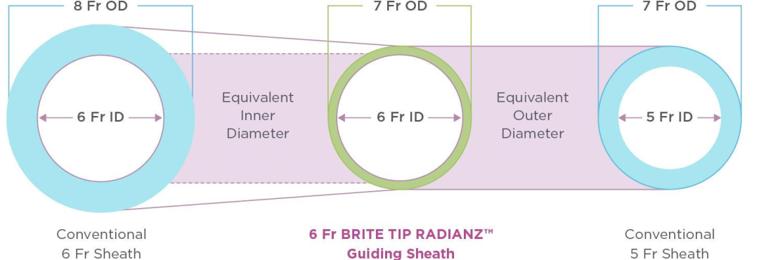 动脉长鞘怎么置入桡胜一筹丨杨敏教授团队：应用Brite Tip Radianz长鞘经远桡动脉治疗肾动脉狭窄一例_https://www.jmylbn.com_新闻资讯_第32张