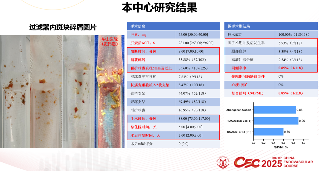 波科支架怎么样波科@CEC2025｜TCAR新技术手术交流会精彩荟萃_https://www.jmylbn.com_新闻资讯_第6张