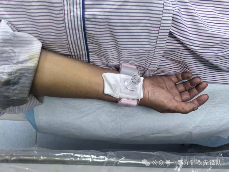 桡动脉鞘怎么读桡胜一筹丨牛猛教授团队：应用Brite Tip RADIANZ长鞘经桡动脉入路治疗脾动脉瘤一例_https://www.jmylbn.com_新闻资讯_第11张