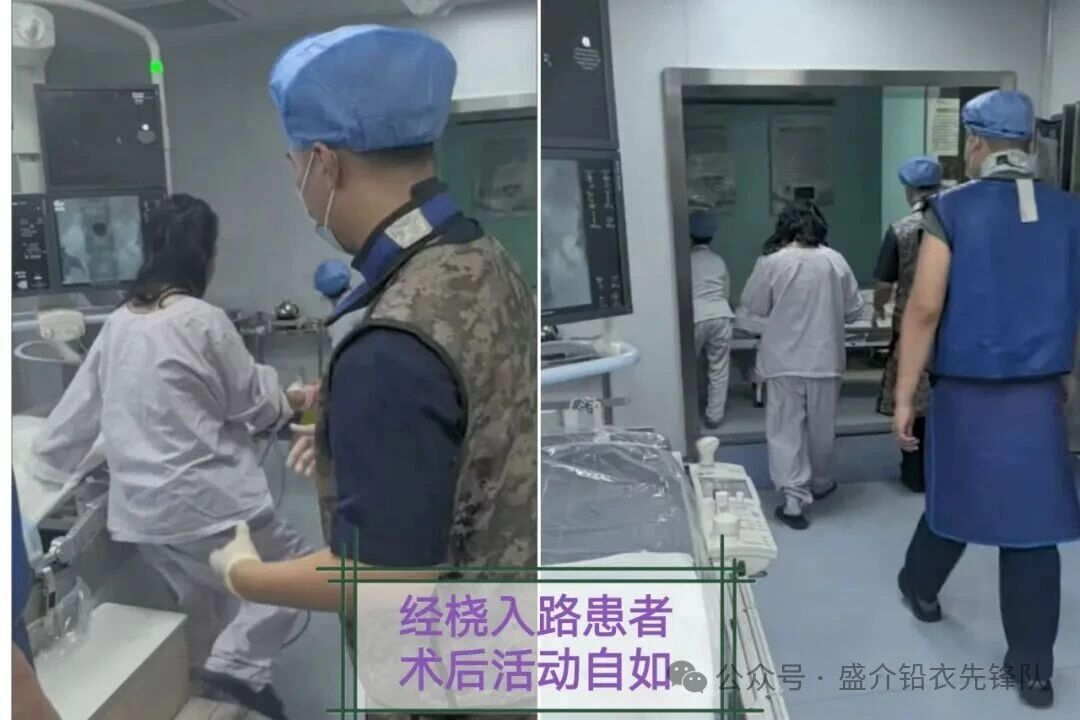 桡动脉鞘怎么读桡胜一筹丨牛猛教授团队：应用Brite Tip RADIANZ长鞘经桡动脉入路治疗脾动脉瘤一例_https://www.jmylbn.com_新闻资讯_第12张