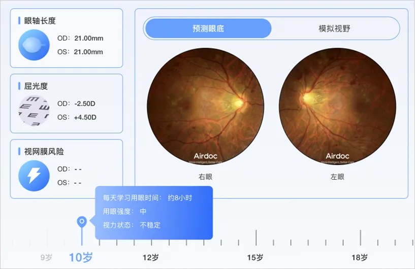 眼底照相机怎么8万亿市场!新一代AI眼底相机AFC引爆医疗圈_新闻资讯_第4张_活检穿刺产品网 眼底照相机怎么8万亿市场!新一代AI眼底相机AFC引爆医疗圈_https://www.jmylbn.com_新闻资讯_第4张