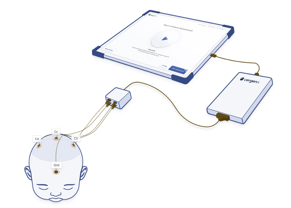 美国脑电图机有哪些FDA突破性设备认定！当新生儿脑电监测不再难_https://www.jmylbn.com_新闻资讯_第6张