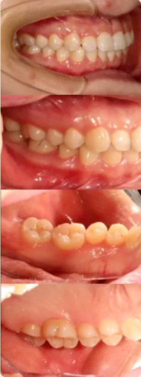 牙医看过来！正畸照片拍摄的正确姿势在这里