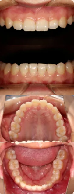 牙医看过来！正畸照片拍摄的正确姿势在这里