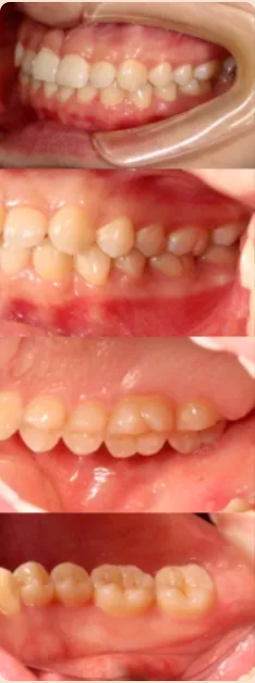 牙医看过来！正畸照片拍摄的正确姿势在这里