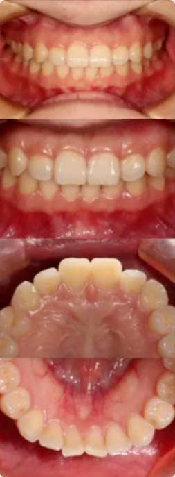 牙医看过来！正畸照片拍摄的正确姿势在这里