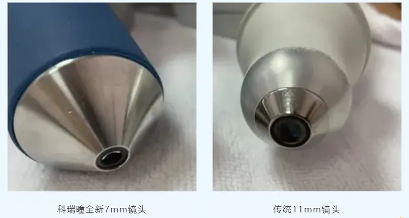 手持眼底相机怎么用全球首款!国产超广角眼科成像系统_新闻资讯_第5张_活检穿刺产品网 手持眼底相机怎么用全球首款!国产超广角眼科成像系统_https://www.jmylbn.com_新闻资讯_第5张