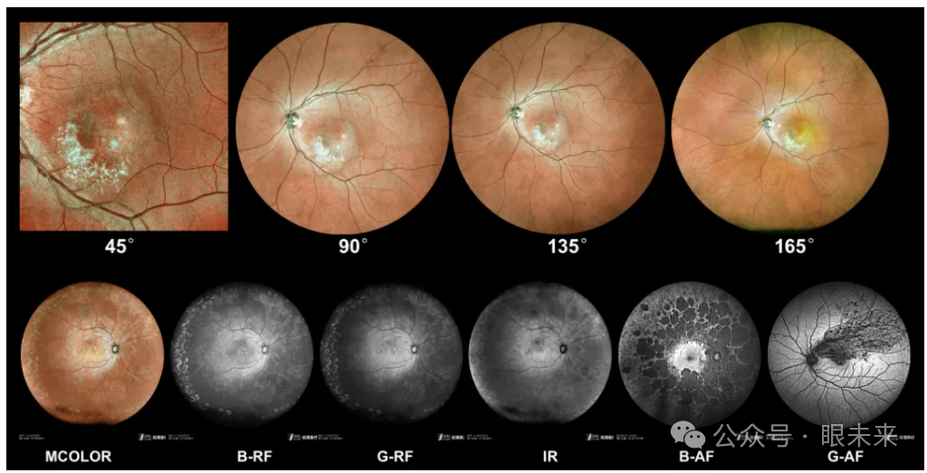 手持眼底相机怎么用1亿元！眼视光“先行者”最新融资_https://www.jmylbn.com_新闻资讯_第7张