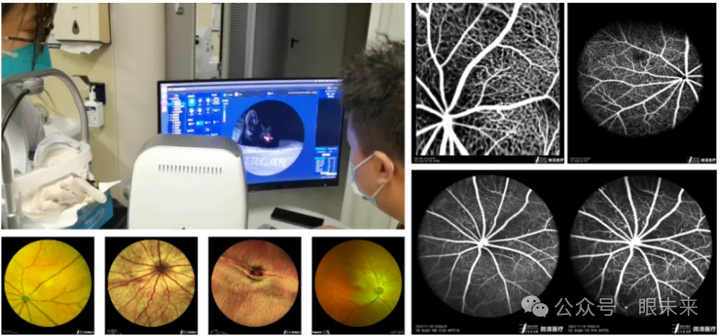 手持眼底相机怎么用1亿元！眼视光“先行者”最新融资_https://www.jmylbn.com_新闻资讯_第8张