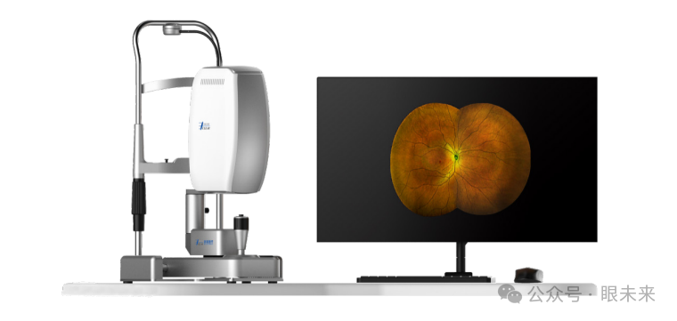 手持眼底相机怎么用1亿元！眼视光“先行者”最新融资_https://www.jmylbn.com_新闻资讯_第6张