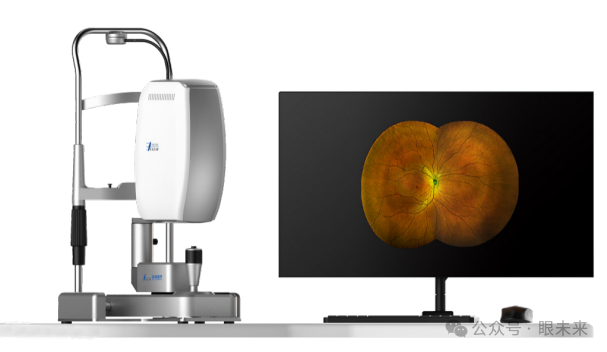眼底激光机有什么牌子【行业资讯】2024年最新！眼科激光诊断设备中标报告_https://www.jmylbn.com_新闻资讯_第6张