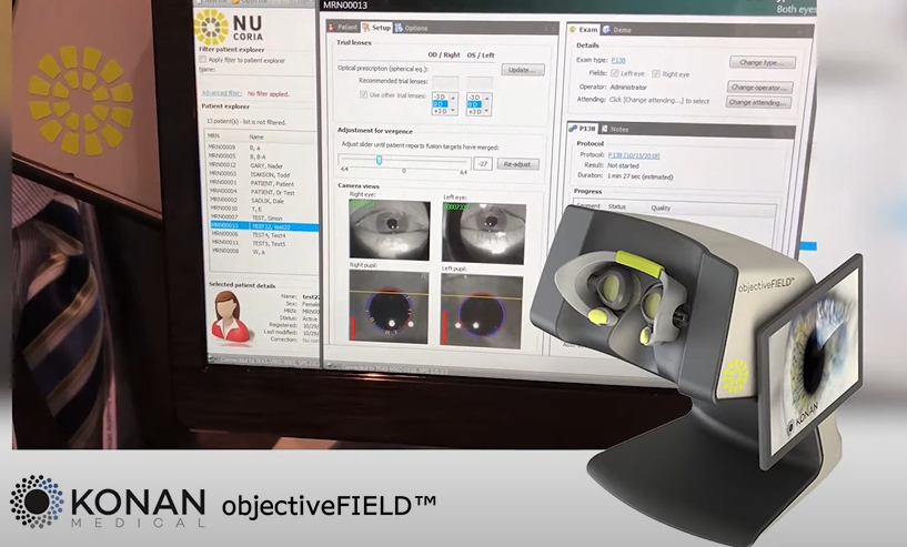 眼科视野计有哪些牌子新品上市！真正客观的视野分析仪_https://www.jmylbn.com_新闻资讯_第6张