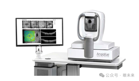 Oct什么公司一文概览眼科OCT市场概况_https://www.jmylbn.com_新闻资讯_第14张