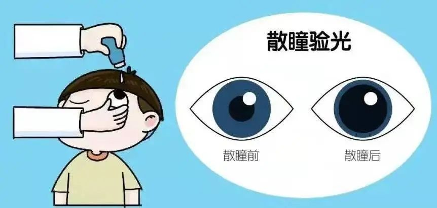 散瞳对孩子的眼睛有伤害吗？(图4)
