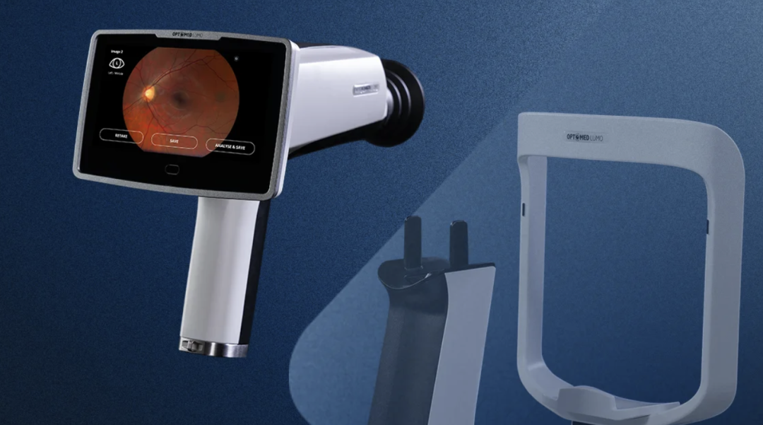 手持眼底相机怎么用最新发布！新一代手持眼底相机_https://www.jmylbn.com_新闻资讯_第1张