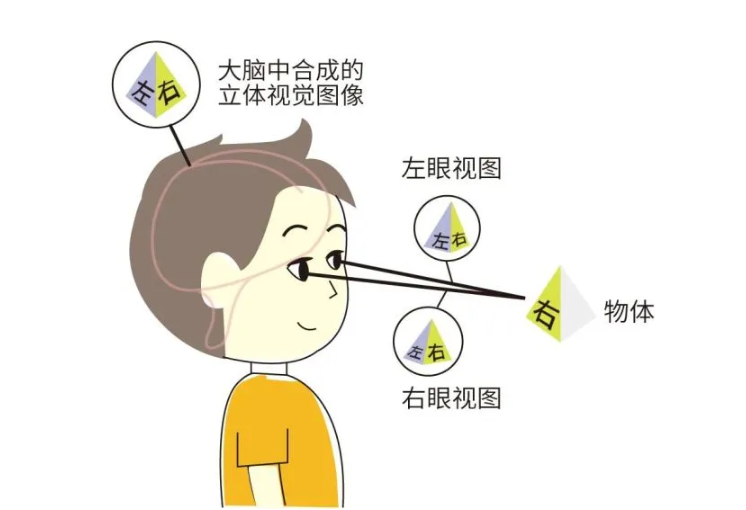 弱视视功能训练视觉恢复与优化的必经之路
