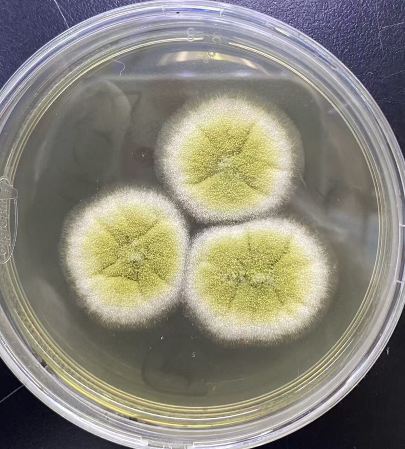 黄曲霉。受访者供图