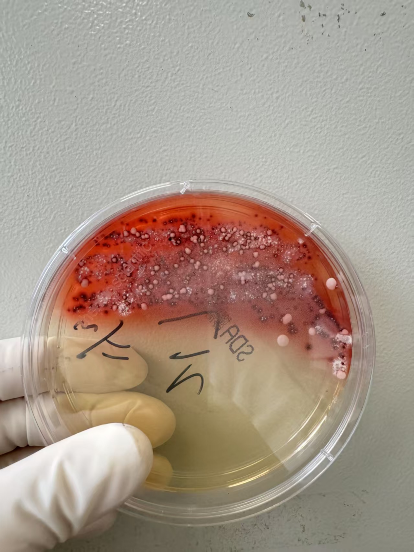 马尔尼菲青霉菌。受访者供图