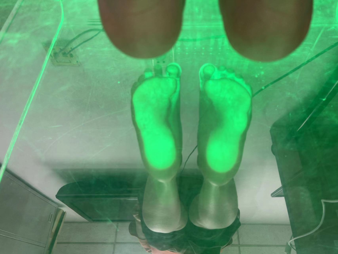 步态分析上曲线怎么解读康复科普｜常见异常步态的介绍及测试_https://www.jmylbn.com_新闻资讯_第14张