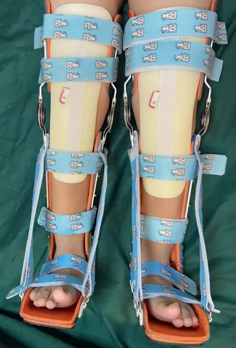 步态分析上曲线怎么解读康复科普｜常见异常步态的介绍及测试_https://www.jmylbn.com_新闻资讯_第22张