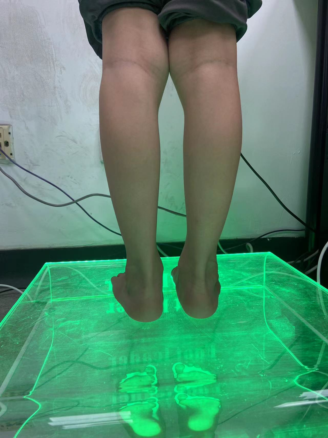 步态分析上曲线怎么解读康复科普｜常见异常步态的介绍及测试_https://www.jmylbn.com_新闻资讯_第17张