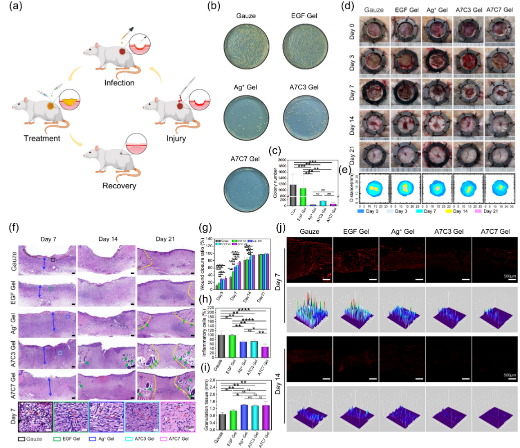 医用抗菌水凝胶怎么用四川大学华西医院骨科研究所解慧琪团队： 一种基于“点击”化学交联原位水凝胶通过抗菌、抗氧化和抗炎活性提高感染性伤口的治疗效果_https://www.jmylbn.com_新闻资讯_第6张