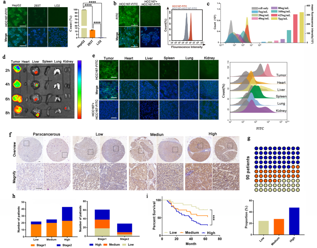 pl在医学中是什么意思四川大学华西医院生物治疗国家重点实验室门可研究员团队：ALPPL2 结合肽介导的mRNA靶向递送制剂用于肝癌的基因治疗_https://www.jmylbn.com_新闻资讯_第3张