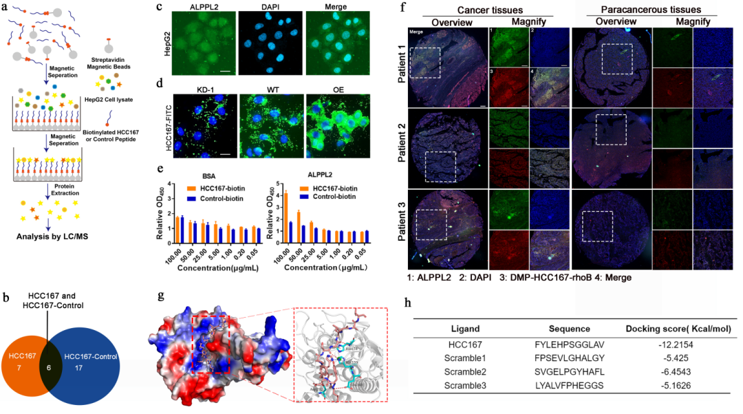 pl在医学中是什么意思四川大学华西医院生物治疗国家重点实验室门可研究员团队：ALPPL2 结合肽介导的mRNA靶向递送制剂用于肝癌的基因治疗_https://www.jmylbn.com_新闻资讯_第6张