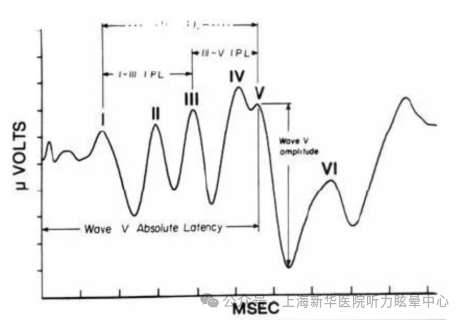 听性脑干反应检查是什么宝爸宝妈看过来，不容忽视的听性脑干反应(ABR)检查_https://www.jmylbn.com_新闻资讯_第9张