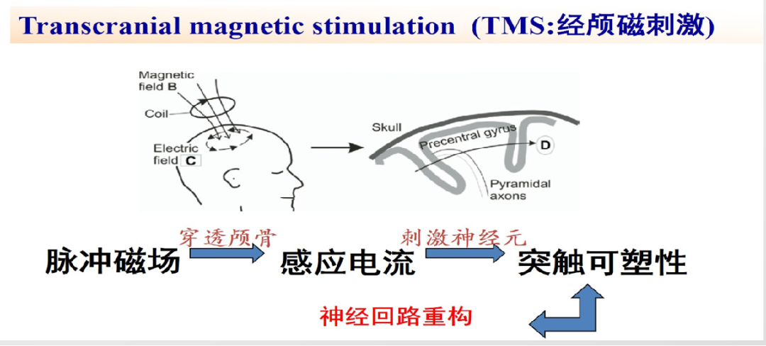 磁脉冲是什么什么是经颅磁刺激、重复经颅磁刺激？_https://www.jmylbn.com_新闻资讯_第2张