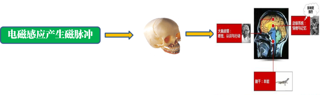 磁脉冲是什么什么是经颅磁刺激、重复经颅磁刺激？_https://www.jmylbn.com_新闻资讯_第3张