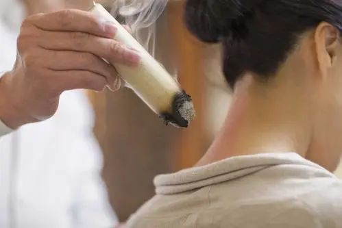 导什么针什么作用小银针大作用-关于针灸您了解多少？_https://www.jmylbn.com_新闻资讯_第4张