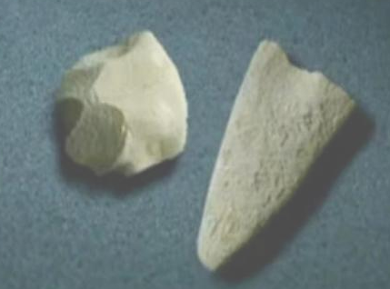 导什么针什么作用小银针大作用-关于针灸您了解多少？_https://www.jmylbn.com_新闻资讯_第6张