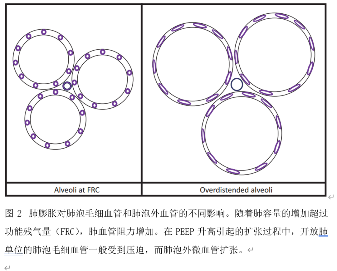 呼吸机是起什么作用PEEP在呼吸机诱发性肺损伤中的作用_https://www.jmylbn.com_新闻资讯_第3张