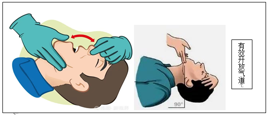 cpr按压板怎么用心肺复苏（CPR+AED）教程来啦_https://www.jmylbn.com_新闻资讯_第6张