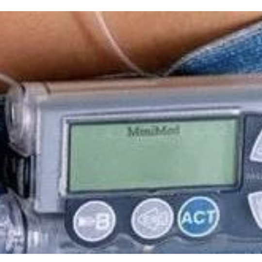 注射器怎么看毫升图独家抗糖秘笈之注射篇 ｜ 一表读懂胰岛素注射装置_https://www.jmylbn.com_新闻资讯_第20张