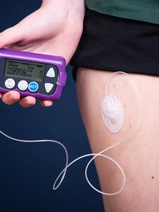 注射器怎么看毫升图独家抗糖秘笈之注射篇 ｜ 一表读懂胰岛素注射装置_https://www.jmylbn.com_新闻资讯_第18张