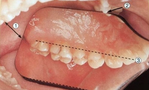 牙医看过来！正畸照片拍摄的正确姿势在这里