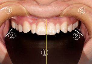 牙医看过来！正畸照片拍摄的正确姿势在这里