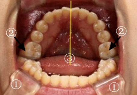 牙医看过来！正畸照片拍摄的正确姿势在这里