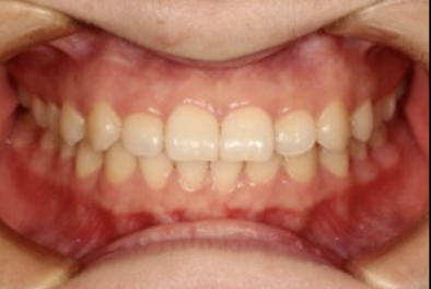 牙医看过来！正畸照片拍摄的正确姿势在这里