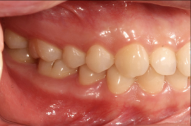 牙医看过来！正畸照片拍摄的正确姿势在这里