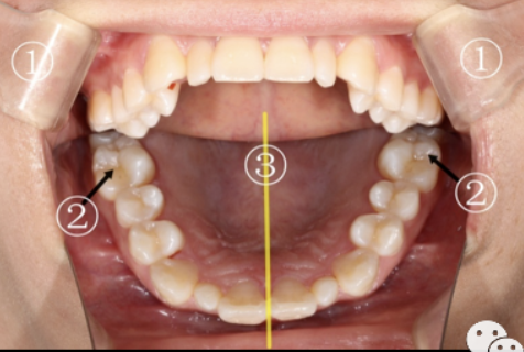 牙医看过来！正畸照片拍摄的正确姿势在这里