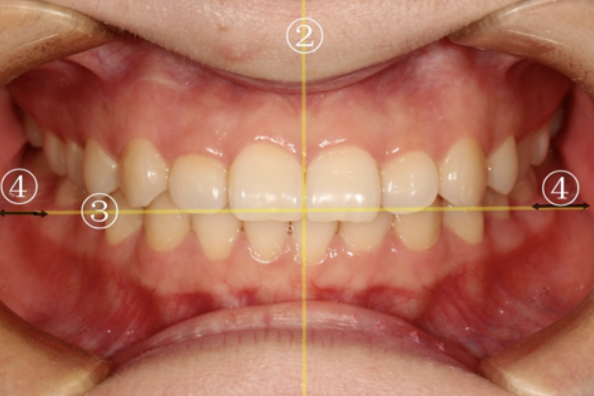 牙医看过来！正畸照片拍摄的正确姿势在这里
