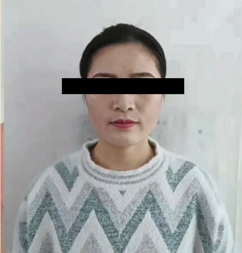 牙医看过来！正畸照片拍摄的正确姿势在这里