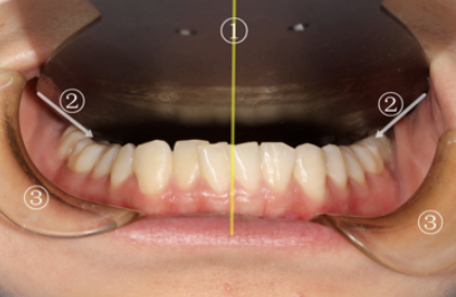 牙医看过来！正畸照片拍摄的正确姿势在这里