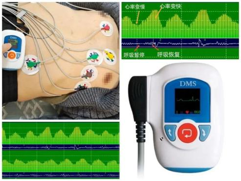 睡眠呼吸初筛仪怎么用更方便，更快捷！动态呼吸监测：高效筛查睡眠呼吸暂停_https://www.jmylbn.com_新闻资讯_第7张