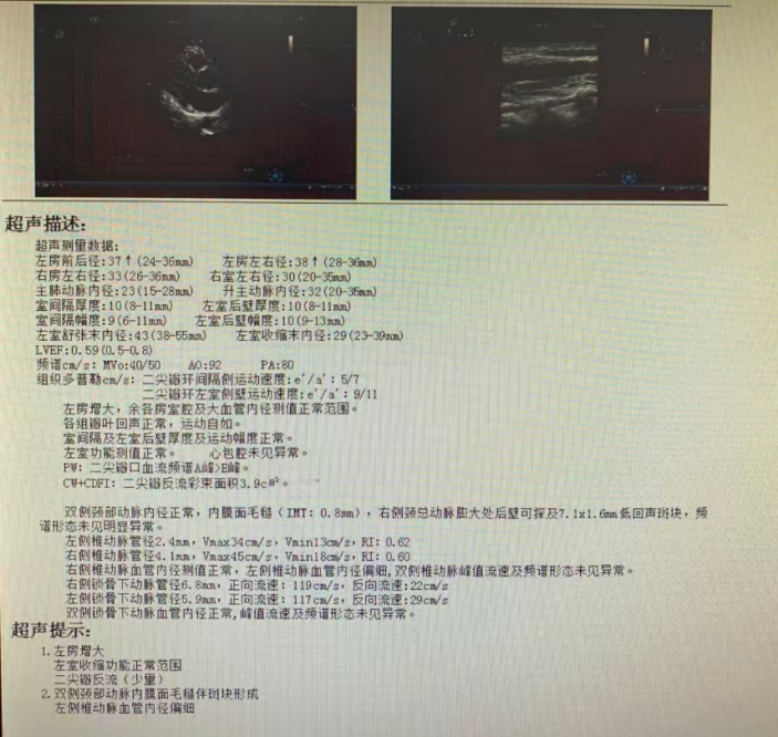 胸痛元凶竟是“全身性炎症”：一例非典型冠脉病变的诊疗陷阱